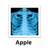 X-Ray on Apple iOS