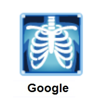 X-Ray on Google Android